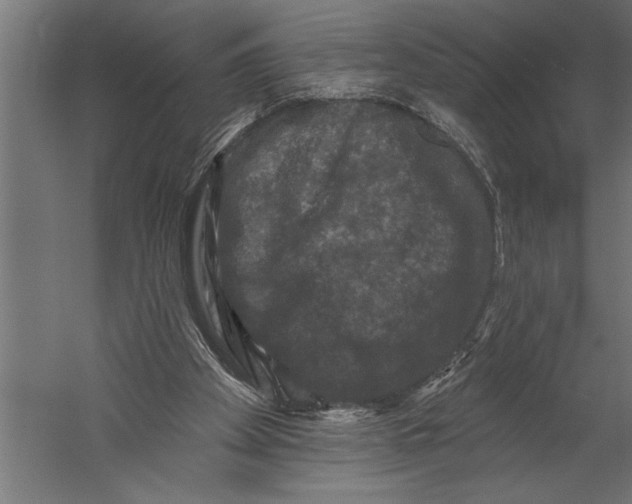 X0000060220105200511241250