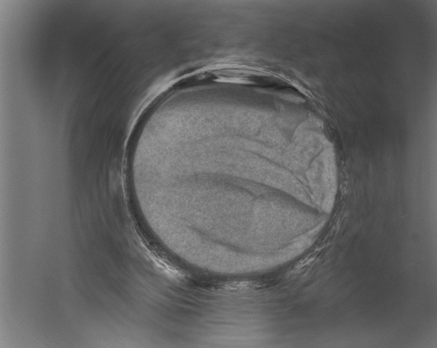 X0000060220152200511241249