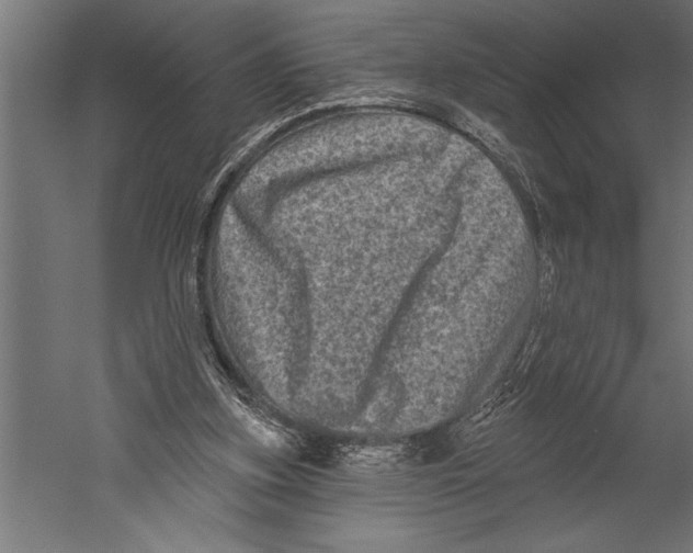 X0000060220155200511241249