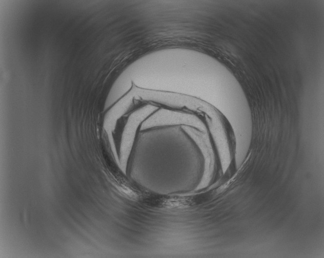 X0000060220175200511241249