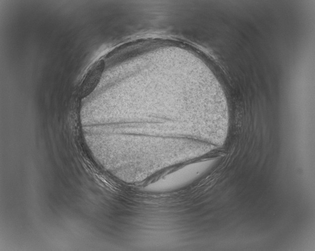 X0000060241359200511241322