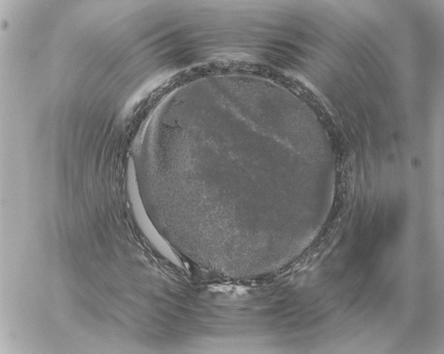 X0000060260919200511112017