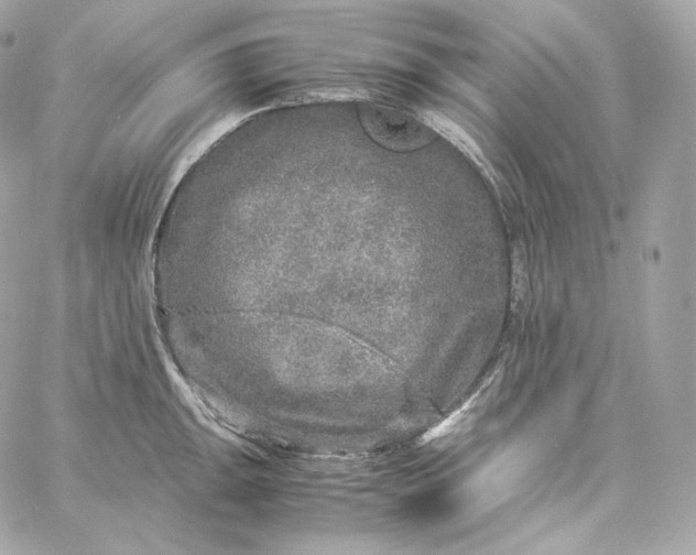 X0000060261047200511112016