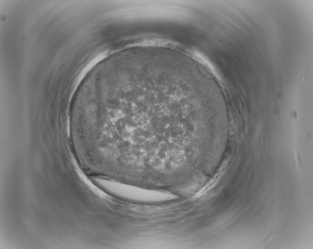 X0000060261095200511112015