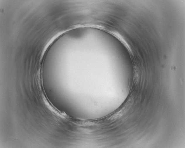 X0000060261100200511112014