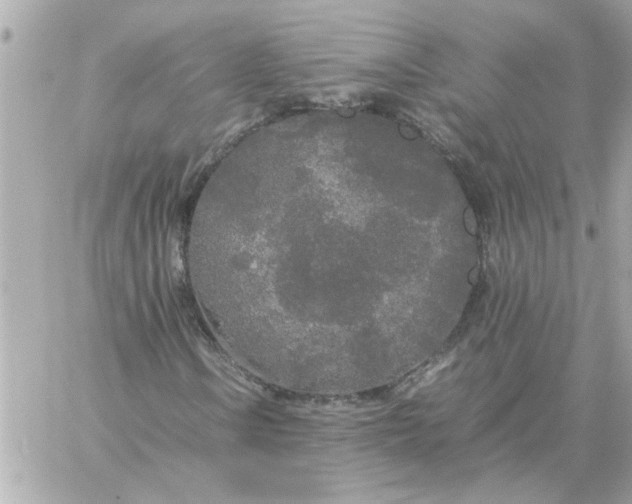 X0000060261106200511112014