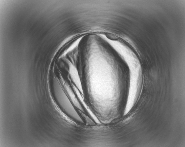 X0000060281142200511181315