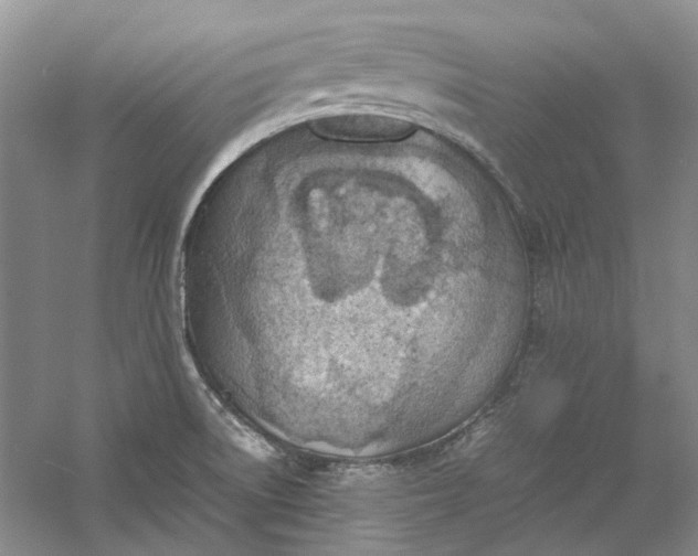 X0000060551522200511171525