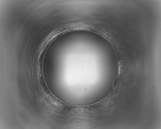 X0000060560339200511171611