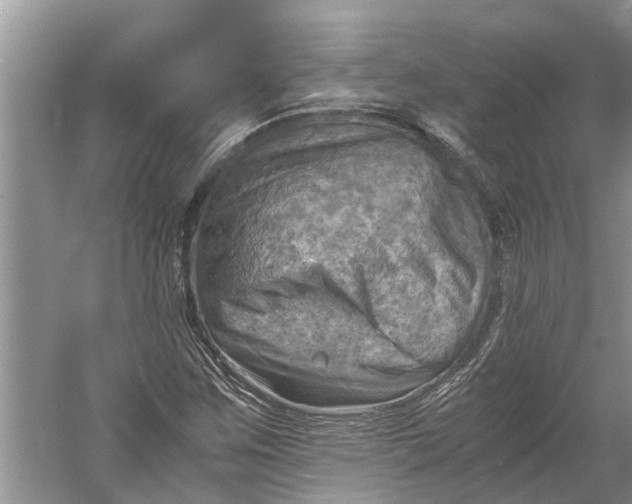 X0000060571259200511171622