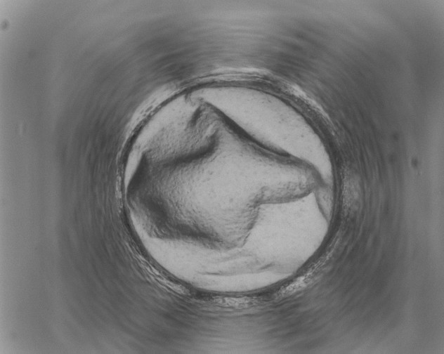 X0000060581362200512011722