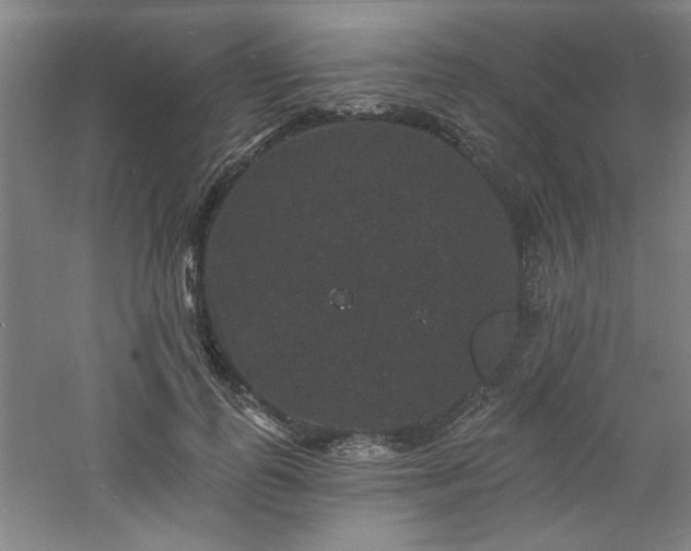 X0000060790747200511101418