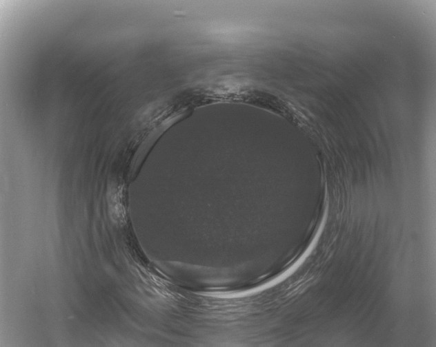 X0000060791156200511141436