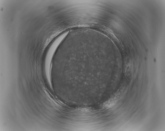 X0000060790299200511171315