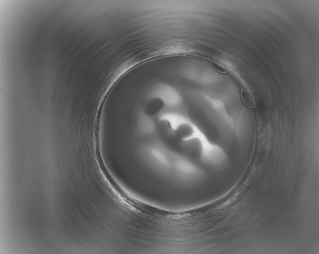 X0000061100810200511210905