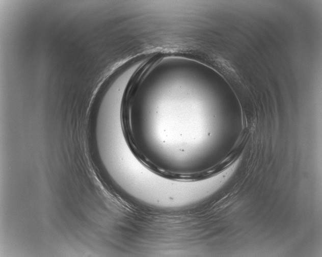 X0000061110540200511181132