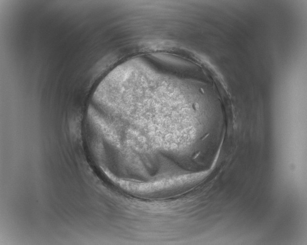 X0000061110010200512022138