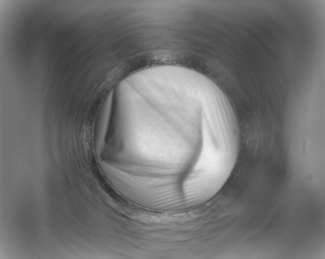 X0000061110036200512022137