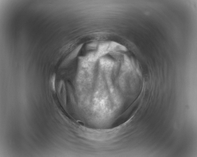 X0000061110047200512022137