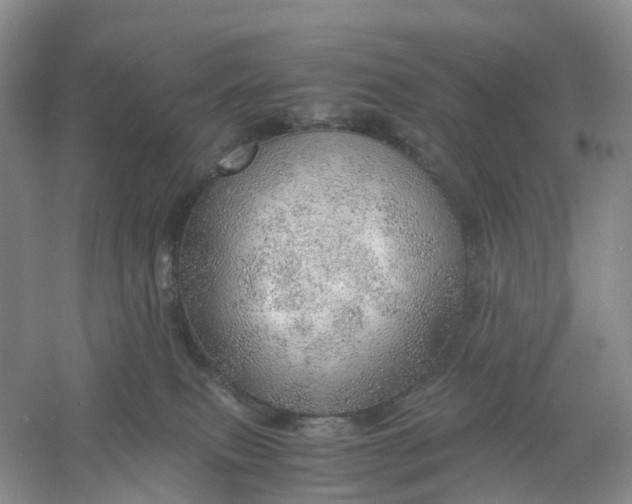 X0000061110087200512022137