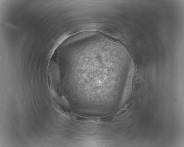 X0000061110099200512022136