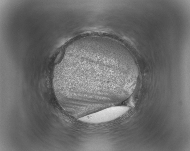 X0000061111159200512022118