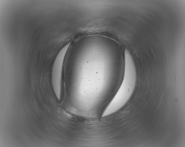 X0000061111300200512022115