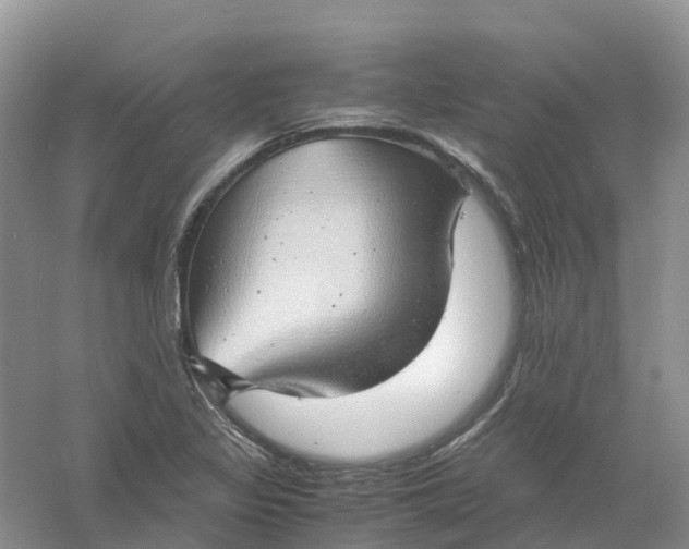 X0000061111317200512022115