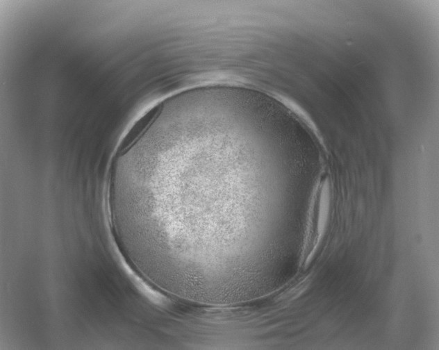 X0000061111391200512022114