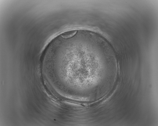 X0000061111501200512022111