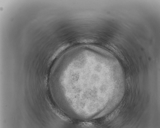 X0000061110159200512091826