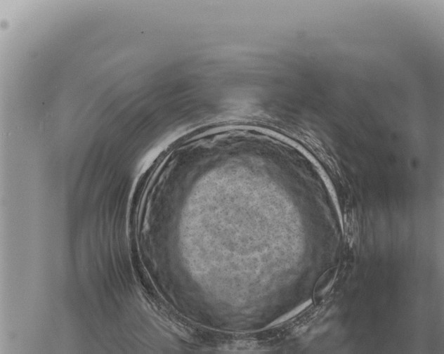 X0000061110196200512091826