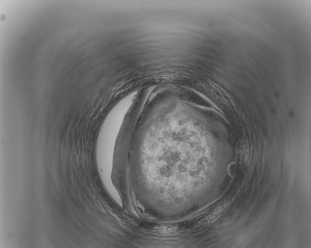 X0000061110660200512091818