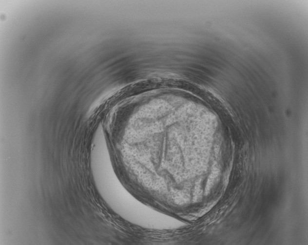 X0000061110919200512091813