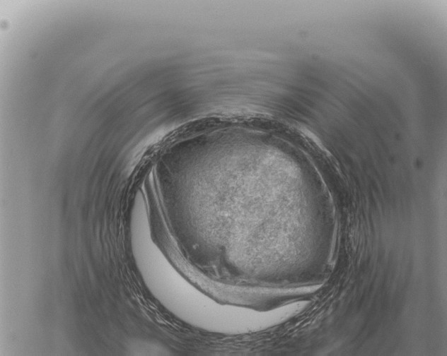 X0000061111016200512091811