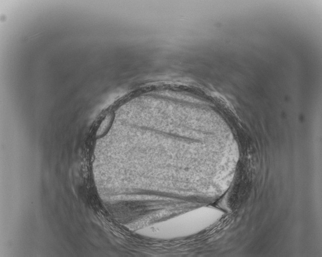 X0000061111159200512091810