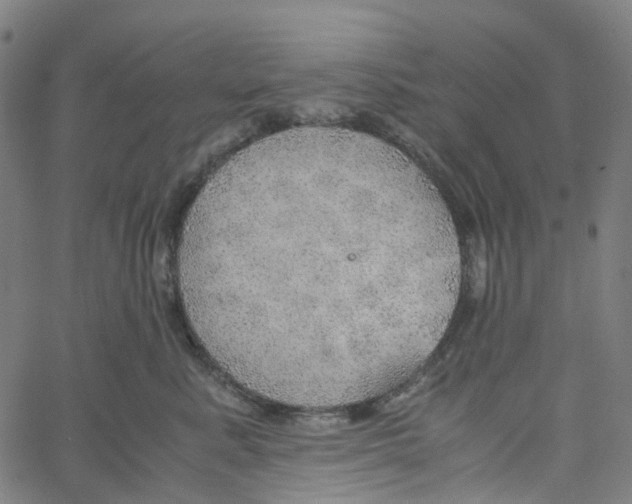 X0000061110619200512161415