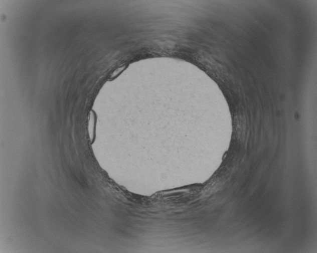 X0000061111057200512161408