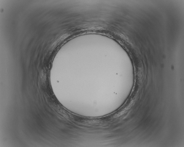 X0000061111257200512161404