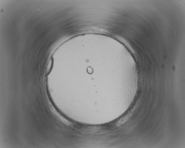 X0000061111387200512161402