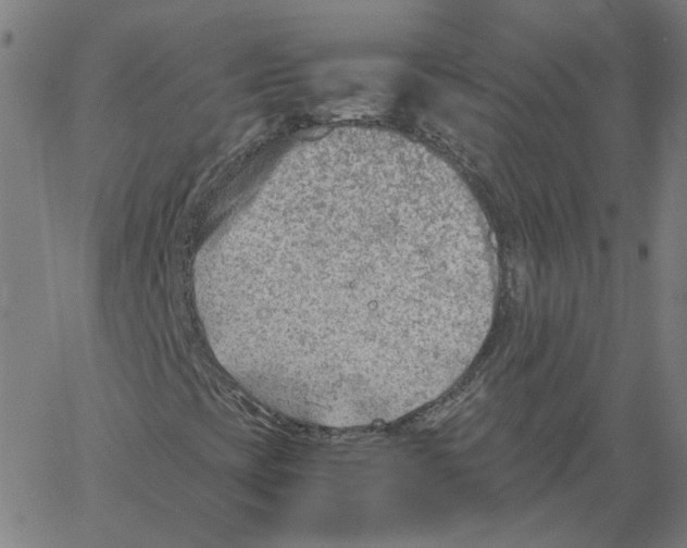 X0000061111393200512161401