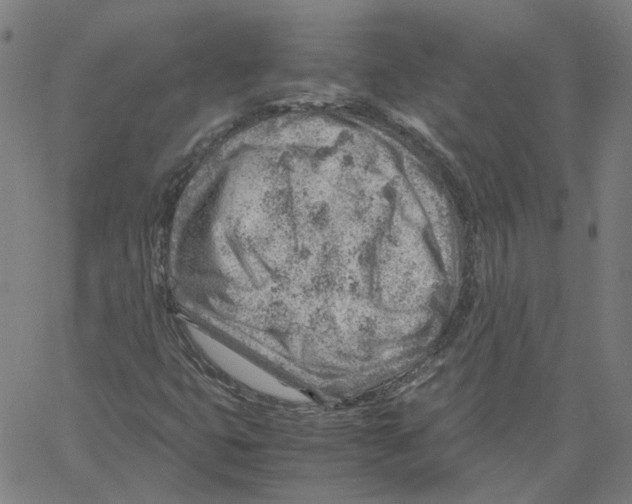 X0000061111399200512161402