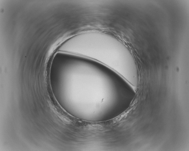 X0000061120150200511180918