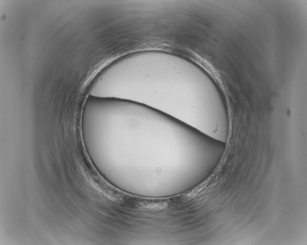 X0000061120155200511180918