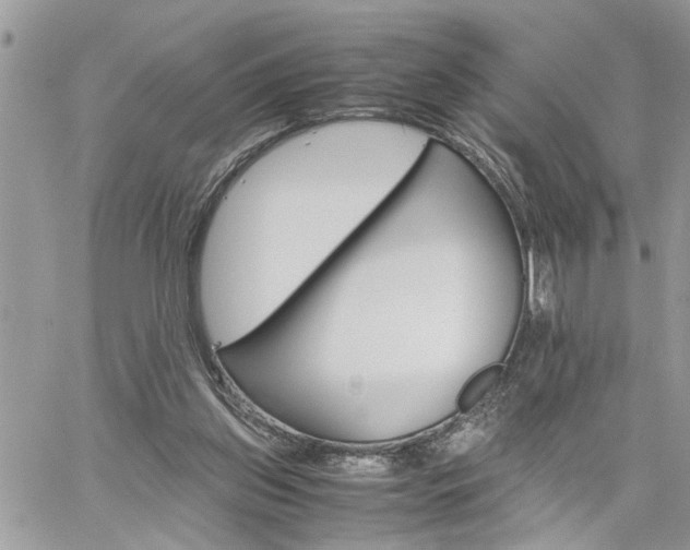 X0000061120157200511181123