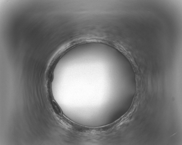 X0000061120197200511211010