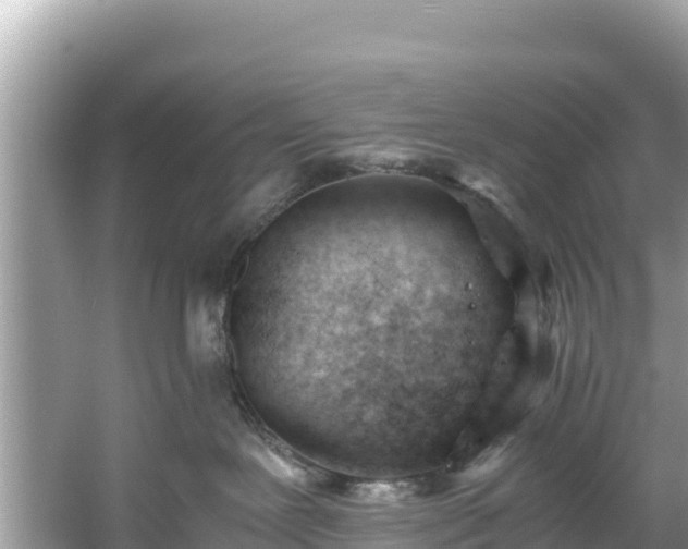 X0000061120239200511211009