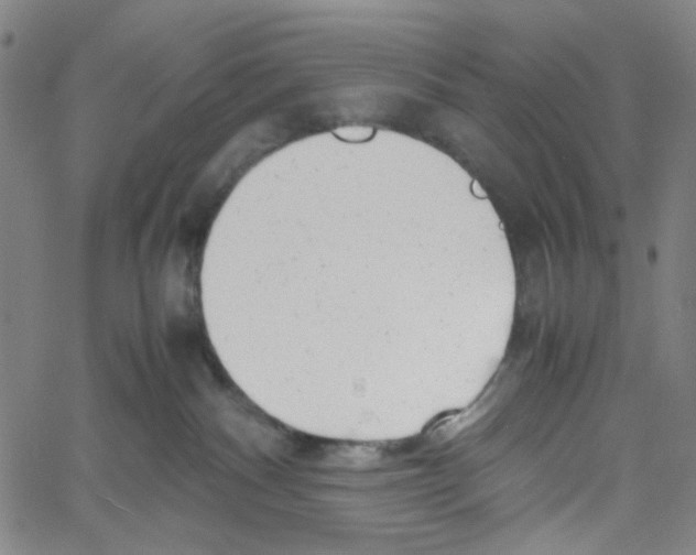 X0000061120140200512161449