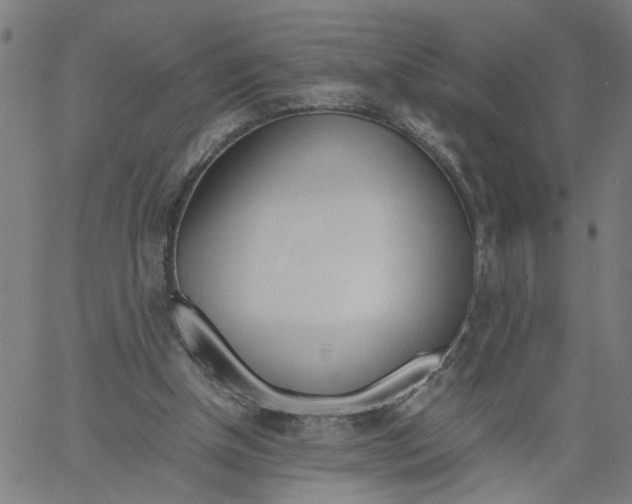 X0000061120154200512161448