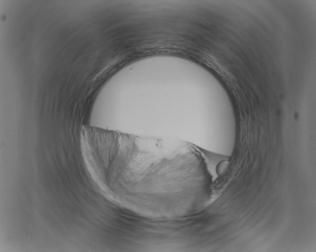 X0000061120165200512161448